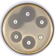 antimicrobial susceptibility